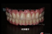一口好牙，打印出来？探秘3D打印牙齿技术如何重塑笑容