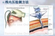 从“保命”到“活得像个正常人”，这些脑损伤技术革新给咱老百姓带来了啥？